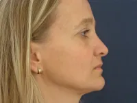 Foto: archiv kliniky ESthÉ