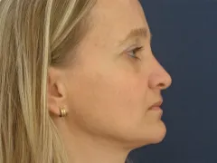 Foto: archiv kliniky ESthÉ