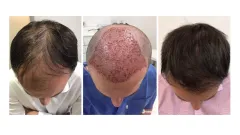 Navraťte svým vlasům krásu díky Clinical Hair&Health - foto 4 | brand photo