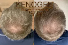 Navraťte svým vlasům krásu díky Clinical Hair&Health - foto 6 | brand photo