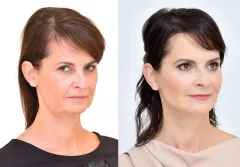 SEDM NEJŽÁDANĚJŠÍCH SLUŽEB PRO NOVÉ ŠŤASTNĚJŠÍ JÁ U YES VISAGE - foto 5 | brand photo