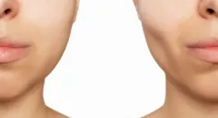  Dejte sbohem tuku v obličeji s FOREO BEAR - foto 2 | brand photo