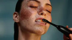 Luxus pro vaše zuby: Dopřejte svému úsměvu extra péči - foto 1 | brand photo