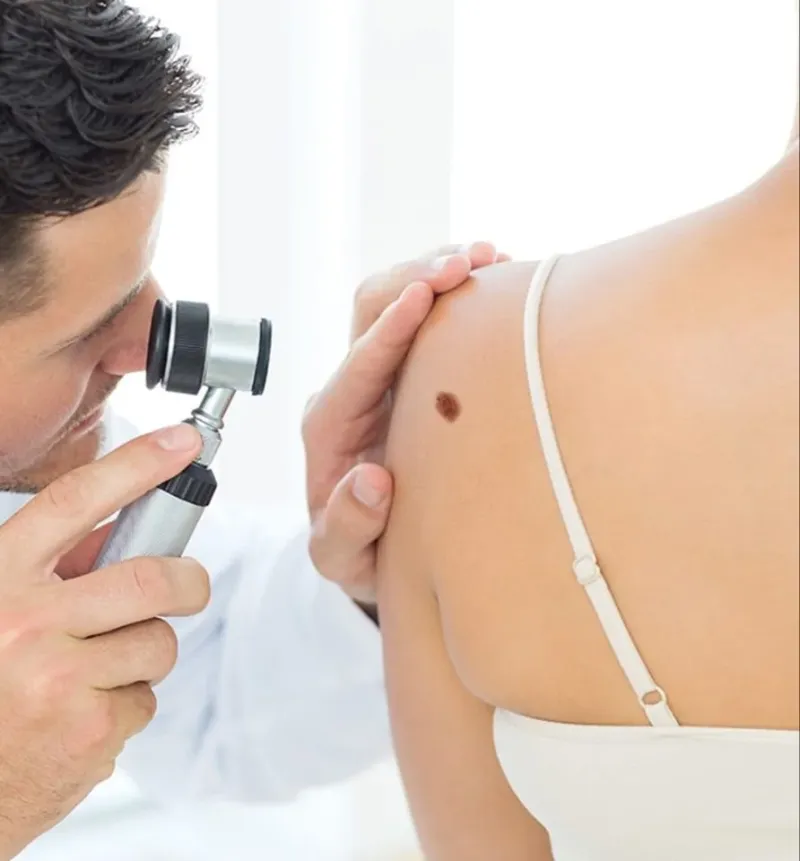 Komplexní péče o Vaši kůži díky Dermacentru - foto 3 | brand photo