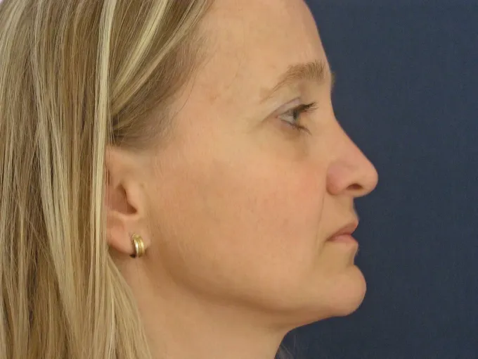 Foto: archiv kliniky ESthÉ