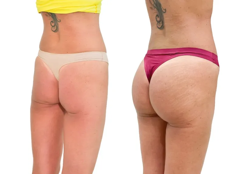 SEDM NEJŽÁDANĚJŠÍCH SLUŽEB PRO NOVÉ ŠŤASTNĚJŠÍ JÁ U YES VISAGE - foto 8 | brand photo