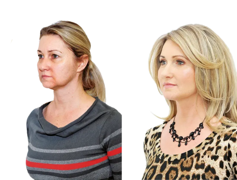 SEDM NEJŽÁDANĚJŠÍCH SLUŽEB PRO NOVÉ ŠŤASTNĚJŠÍ JÁ U YES VISAGE - foto 9 | brand photo