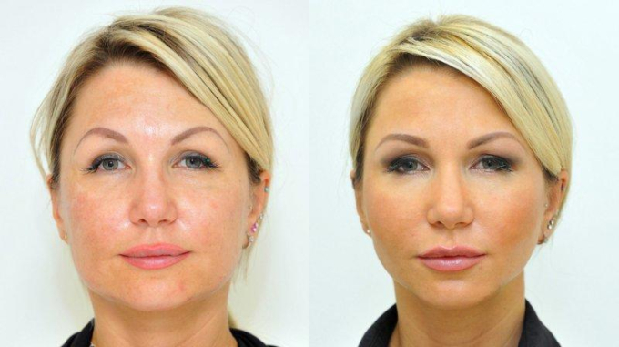 YES FACE CONTOURING YES FACE CONTOURING